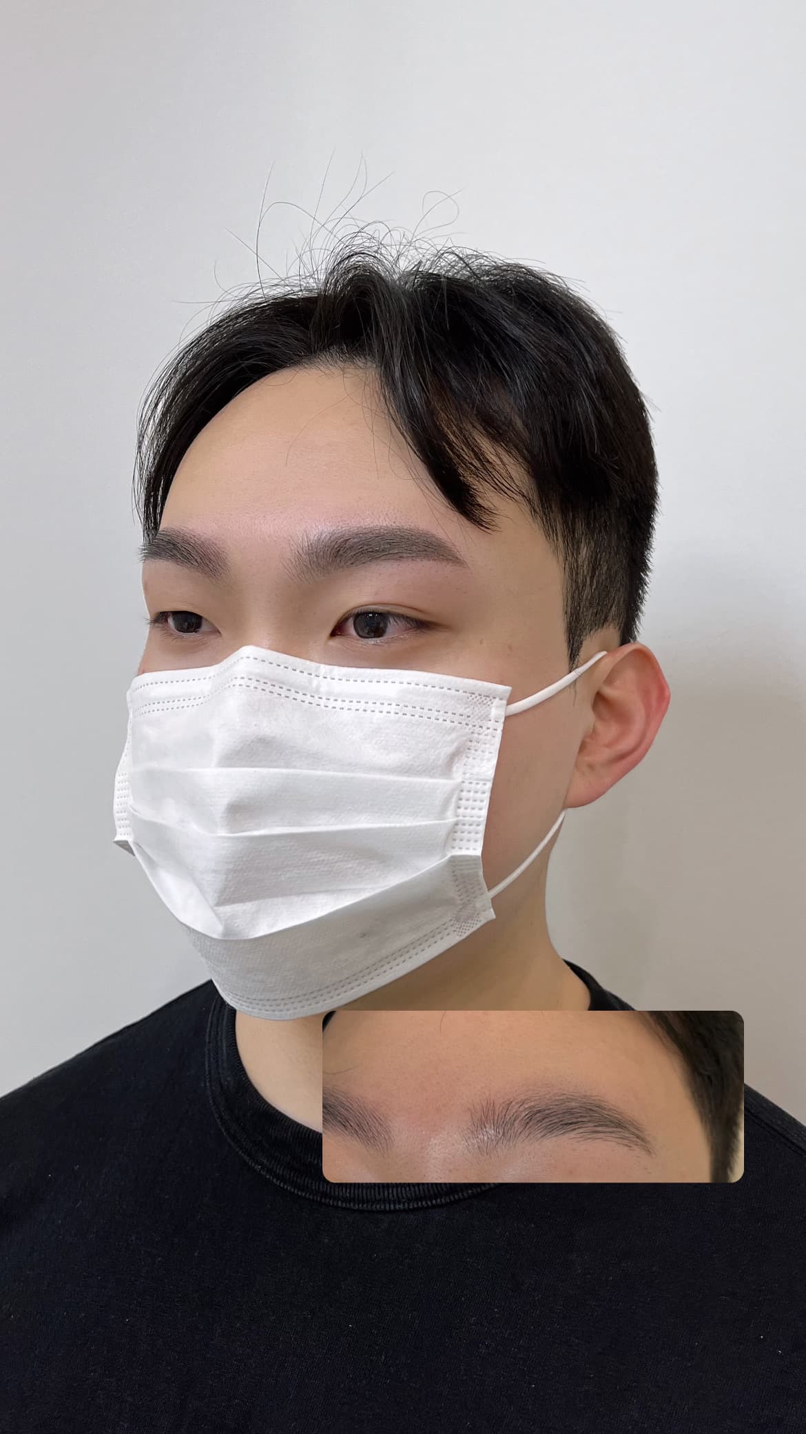 남자 눈썹 시술 2