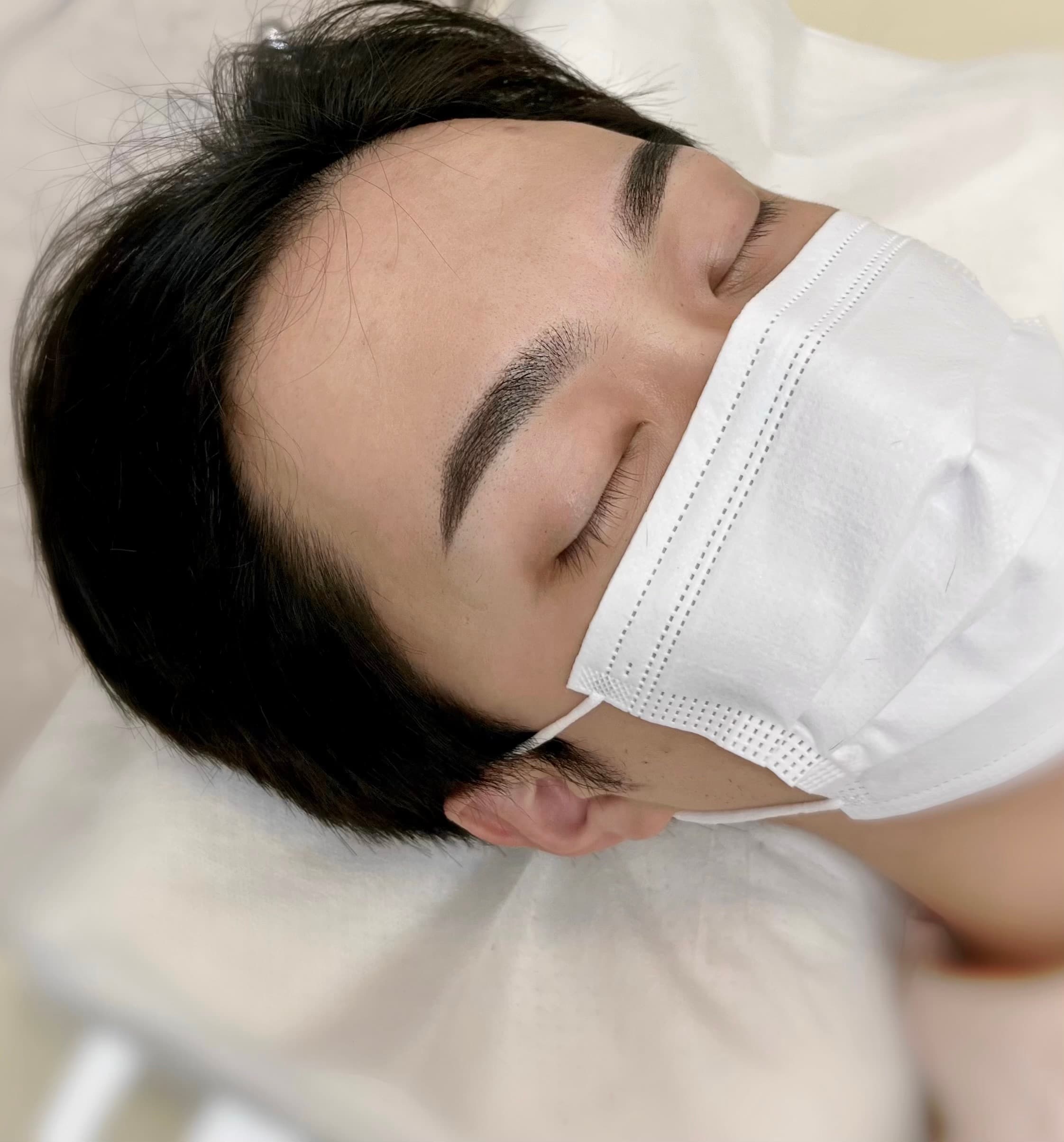 남자 눈썹 시술 4